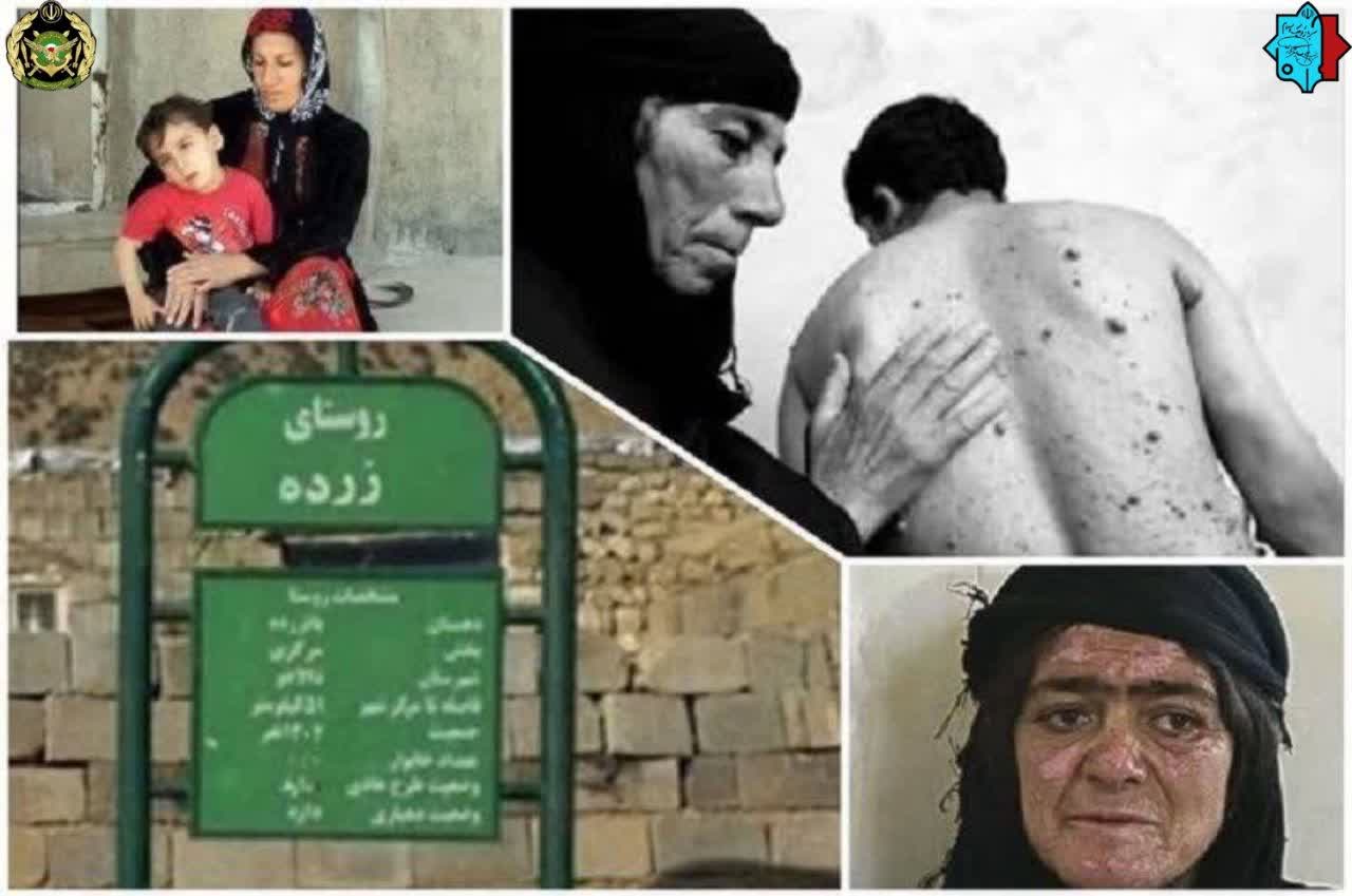 ۳۱ تیرماه سالگرد بمباران شیمیایی روستای زرده کرمانشاه توسط حزب بعث عراق